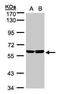 Transforming Growth Factor Beta Regulator 4 antibody, PA5-34727, Invitrogen Antibodies, Western Blot image 