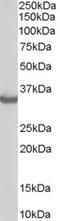 STIP1 Homology And U-Box Containing Protein 1 antibody, EB05327, Everest Biotech, Western Blot image 