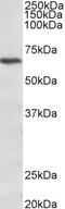 Calcium Voltage-Gated Channel Auxiliary Subunit Beta 2 antibody, STJ72683, St John