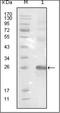 EPH Receptor B3 antibody, orb89386, Biorbyt, Western Blot image 