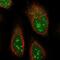 Abhydrolase Domain Containing 14B antibody, NBP1-84472, Novus Biologicals, Immunofluorescence image 