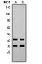 Ovo Like Transcriptional Repressor 1 antibody, orb256738, Biorbyt, Western Blot image 