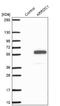 Arrestin Domain Containing 1 antibody, NBP1-91683, Novus Biologicals, Western Blot image 