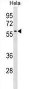 Selenium Binding Protein 1 antibody, abx030957, Abbexa, Western Blot image 