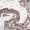 THAP Domain Containing 9 antibody, HPA037421, Atlas Antibodies, Immunohistochemistry paraffin image 