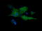 Mitogen-Activated Protein Kinase Kinase 1 antibody, LS-C174637, Lifespan Biosciences, Immunofluorescence image 
