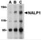 NLR Family Pyrin Domain Containing 1 antibody, 3037, ProSci, Western Blot image 