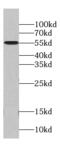 Microspherule Protein 1 antibody, FNab05067, FineTest, Western Blot image 