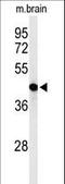 Glycerol-3-phosphate acyltransferase 4 antibody, LS-C156157, Lifespan Biosciences, Western Blot image 