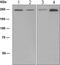 Transient Receptor Potential Cation Channel Subfamily M Member 7 antibody, ab109438, Abcam, Western Blot image 