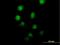 Myeloid Zinc Finger 1 antibody, H00007593-B01P, Novus Biologicals, Immunocytochemistry image 