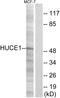 Ribosomal RNA Processing 8 antibody, A30608, Boster Biological Technology, Western Blot image 