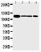 EPH Receptor A2 antibody, PA1744, Boster Biological Technology, Western Blot image 
