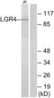 Leucine Rich Repeat Containing G Protein-Coupled Receptor 4 antibody, abx015336, Abbexa, Western Blot image 