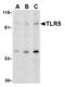 Toll Like Receptor 5 antibody, AP05234PU-N, Origene, Western Blot image 
