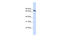 Ubiquilin-1 antibody, ARP54958_P050, Aviva Systems Biology, Western Blot image 