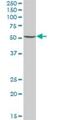 UDP-Glucose 6-Dehydrogenase antibody, H00007358-B01P, Novus Biologicals, Western Blot image 