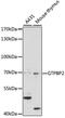 GTP Binding Protein 2 antibody, LS-C750426, Lifespan Biosciences, Western Blot image 