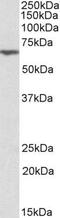 Anthrax toxin receptor 2 antibody, PA5-19295, Invitrogen Antibodies, Western Blot image 