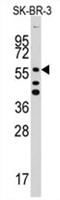 Aldehyde Dehydrogenase 5 Family Member A1 antibody, AP11469PU-N, Origene, Western Blot image 
