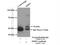 Matrix Metallopeptidase 1 antibody, 26585-1-AP, Proteintech Group, Immunoprecipitation image 