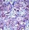 Matrix Metallopeptidase 13 antibody, LS-C164234, Lifespan Biosciences, Immunohistochemistry frozen image 
