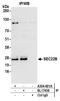 SEC22 Homolog B, Vesicle Trafficking Protein (Gene/Pseudogene) antibody, A304-601A, Bethyl Labs, Immunoprecipitation image 