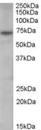 Peptidyl Arginine Deiminase 4 antibody, STJ70617, St John