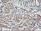Transmembrane Protein With EGF Like And Two Follistatin Like Domains 2 antibody, M03846, Boster Biological Technology, Immunohistochemistry paraffin image 