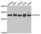 General Transcription Factor IIF Subunit 2 antibody, A5826, ABclonal Technology, Western Blot image 