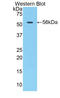 Cathepsin A antibody, LS-C302620, Lifespan Biosciences, Western Blot image 