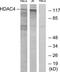 Histone Deacetylase 4 antibody, TA312828, Origene, Western Blot image 