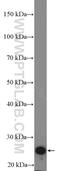 Troponin I3, Cardiac Type antibody, 21652-1-AP, Proteintech Group, Western Blot image 