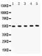 Matrix metalloproteinase-3 antibody, PB9267, Boster Biological Technology, Western Blot image 