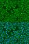 Insulin Like Growth Factor 2 MRNA Binding Protein 1 antibody, LS-C331506, Lifespan Biosciences, Immunofluorescence image 