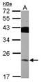 Vacuolar protein sorting-associated protein 29 antibody, NBP2-20871, Novus Biologicals, Western Blot image 