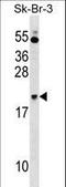 NFKB Inhibitor Interacting Ras Like 1 antibody, LS-C158390, Lifespan Biosciences, Western Blot image 