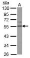 Sprouty Related EVH1 Domain Containing 2 antibody, GTX117851, GeneTex, Western Blot image 