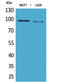 Semaphorin 4D antibody, STJ96624, St John