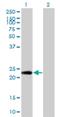 PTTG1 Interacting Protein antibody, H00000754-M04, Novus Biologicals, Western Blot image 