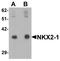 NK2 Homeobox 1 antibody, LS-C153753, Lifespan Biosciences, Western Blot image 