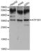 ATPase Na+/K+ Transporting Subunit Beta 1 antibody, abx004438, Abbexa, Western Blot image 