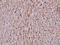 Cytochrome P450 Family 2 Subfamily C Member 18 antibody, A07005-1, Boster Biological Technology, Immunohistochemistry paraffin image 