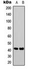 Somatostatin Receptor 1 antibody, orb315713, Biorbyt, Western Blot image 