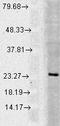 RAB5A, Member RAS Oncogene Family antibody, LS-C232076, Lifespan Biosciences, Western Blot image 