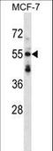 Syntrophin Beta 2 antibody, LS-C161360, Lifespan Biosciences, Western Blot image 