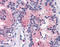 CD298 antibody, TA341332, Origene, Immunohistochemistry paraffin image 