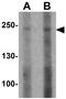 ATP Binding Cassette Subfamily A Member 7 antibody, GTX31856, GeneTex, Western Blot image 