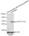 Zeta Chain Of T Cell Receptor Associated Protein Kinase 70 antibody, STJ22448, St John