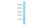 DnaJ Heat Shock Protein Family (Hsp40) Member C19 antibody, PA5-70454, Invitrogen Antibodies, Western Blot image 